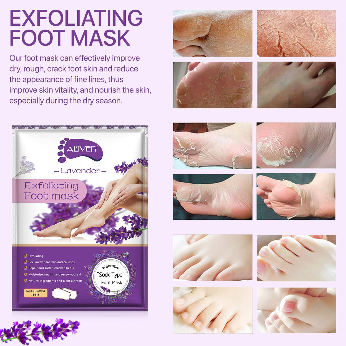 sefudun 3 Pack Foot Peel Mask,Exfoliating Foot Socks Calluses Remover Dead Skin, Aloe Moisturizing Feet Peeling Mask for Dry Skin,Cracked Heels,Foot SPA Socks for Women and Men