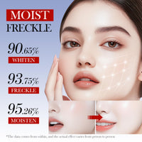 Cureluxe Dark Spot Remover For Face Cream For Women - Freckle Removal Cream – Face Moisturizer For Dark Spots – Hydrating & Skin Tone Enhancing Cream – Fade Freckles & Improve Dull Skin