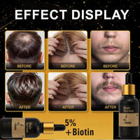 5% + Biotin Hair Serum, 5% Hair Growth Serum For Men And Hair Regrowth Treatment For Stronger Thicker Longer Hair Help to Stop Thinning and Loss Hair 60 ML