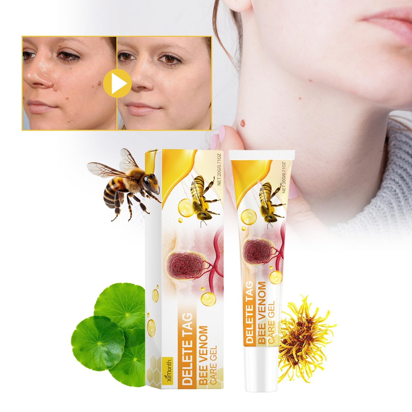 ponizno Wart Remover, Skin TagRemovel for Hands and Body Easy to Use Natural & Safe Remover