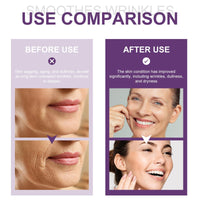 Ruojiar Bakuchiol Plumping Serum,Bakuchiol Serum with Niacinamide for Skin,Skin Brightening Serum for Women,Skincare Se/rum,Reduce Wrinkles and Fine Lines,Hydrating,Smoothing,Moisturizing,Pore Minimizer