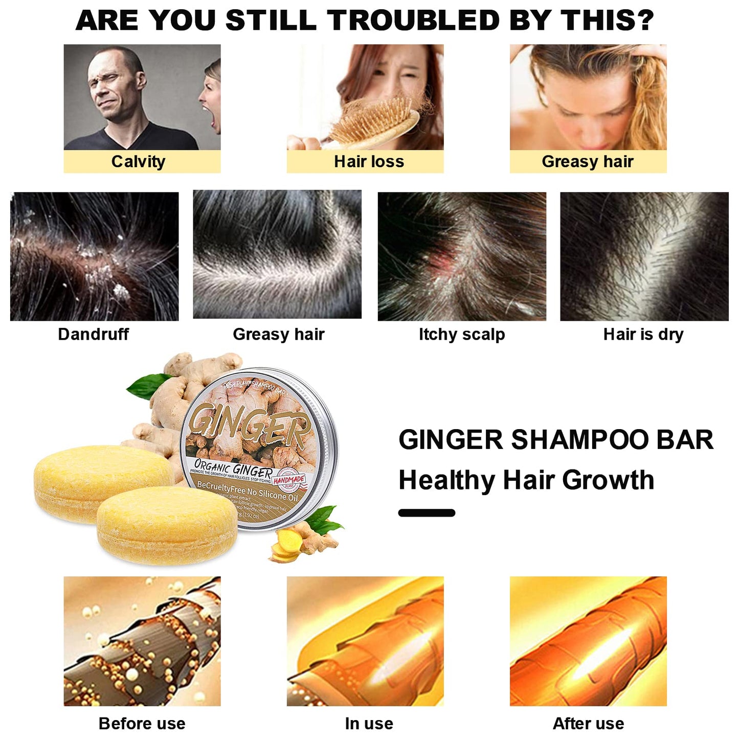 Samkeen Ginger Hair Shampoo Bar, Ginger Shampoo Bar, Ginger Shampoo Soap, Natural Organic Ginger Shampoo Soap for All Hair Types, Moisturize Hair and Control Oil (2pcs Ginger)