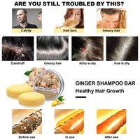 Samkeen Ginger Hair Shampoo Bar, Ginger Shampoo Bar, Ginger Shampoo Soap, Natural Organic Ginger Shampoo Soap for All Hair Types, Moisturize Hair and Control Oil (2pcs Ginger)