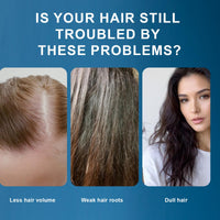 Orknglowy 2PCS Copper Peptide Hair Serum Growth for Women & Men, Hair Serum for Hair Growth with Castor Oil, Reduces Hair Loss, Promotes Hair Regrowth, Repair Damaged Hair, Hair Oil for Dry Damaged Hair