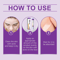 QinZiEn Acid Face Cream,Acid 12% Facial Serum Cream,Acne Treatment for Face,Skincare with Niacinamide & Vitamin C,Acne Scar Removal Cr/eam Night Serum for Face,Dark Spot Serum Crea/m,Acne Moisturiser,20g