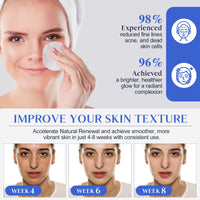 Generic Glycolic Acid Facial Pads 60 Count - 10% Glycolic Acid+2% Salicylic Acid for Gentle Exfoliation, Refined Pores. Allantoin + Vitamins C & E for Deep Nourishment, Radiant Skin Renewal.