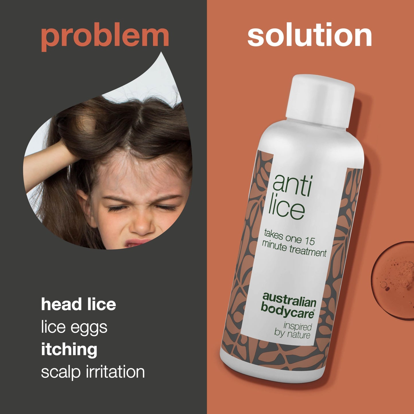 Lice Treatment from Australian Bodycare 100ml | Effective After a Single 15-Minute Treatment | This Head lice Treatment is Free of parabens and insecticides | Nit Treatment with Natural Tea Tree Oil