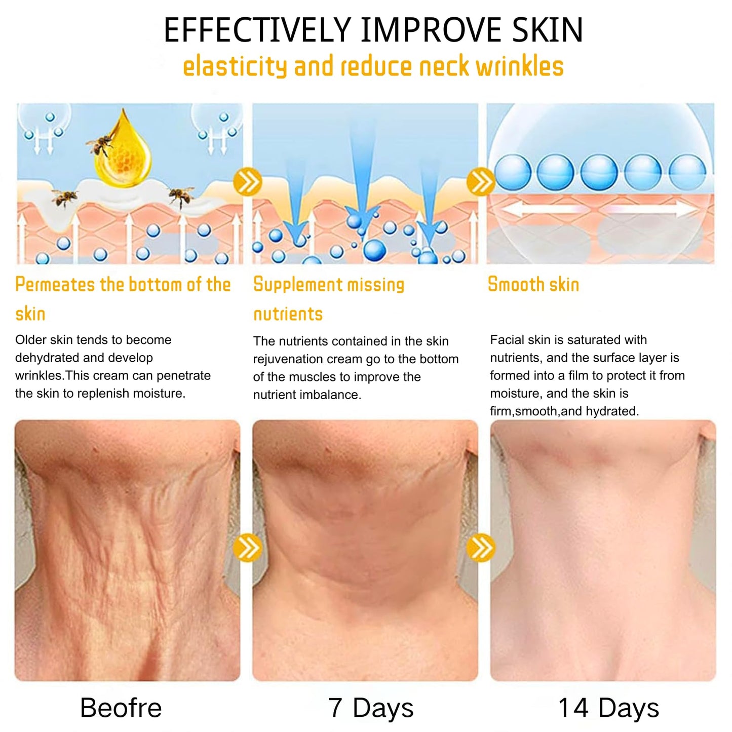 IZBEAUVO Bee Lift Anti Aging Firming Body Cream, Bee Venom Wrinkle Removal Cream, Collagen Firming Body Lotion, Neck FirmingCream For Loose Skin, Skin Tightening CreamBody, Restore Elasticity, Hydration