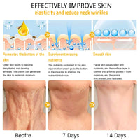 IZBEAUVO Bee Lift Anti Aging Firming Body Cream, Bee Venom Wrinkle Removal Cream, Collagen Firming Body Lotion, Neck FirmingCream For Loose Skin, Skin Tightening CreamBody, Restore Elasticity, Hydration