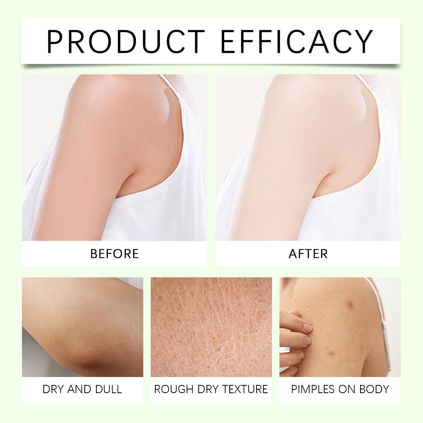 Generic Oasis Neuropathy Cream, 4oz Magnesium Body Butter, Soothing Skin Discomfort, Repair Damaged Skin, Deeply Moisturizes, Keep Soft Smooth, Suitable for All Skin Types (1)