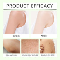 Generic Oasis Neuropathy Cream, 4oz Magnesium Body Butter, Soothing Skin Discomfort, Repair Damaged Skin, Deeply Moisturizes, Keep Soft Smooth, Suitable for All Skin Types (1)