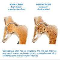 Densiboost Bone Remineralisation 60 Capsules (not Tablets) with Calcium, Magnesium, Manganese, Phosphorus, Copper, Boron, Zinc and Vitamins D3 and K2 MK-7. Made in The UK by Health4All