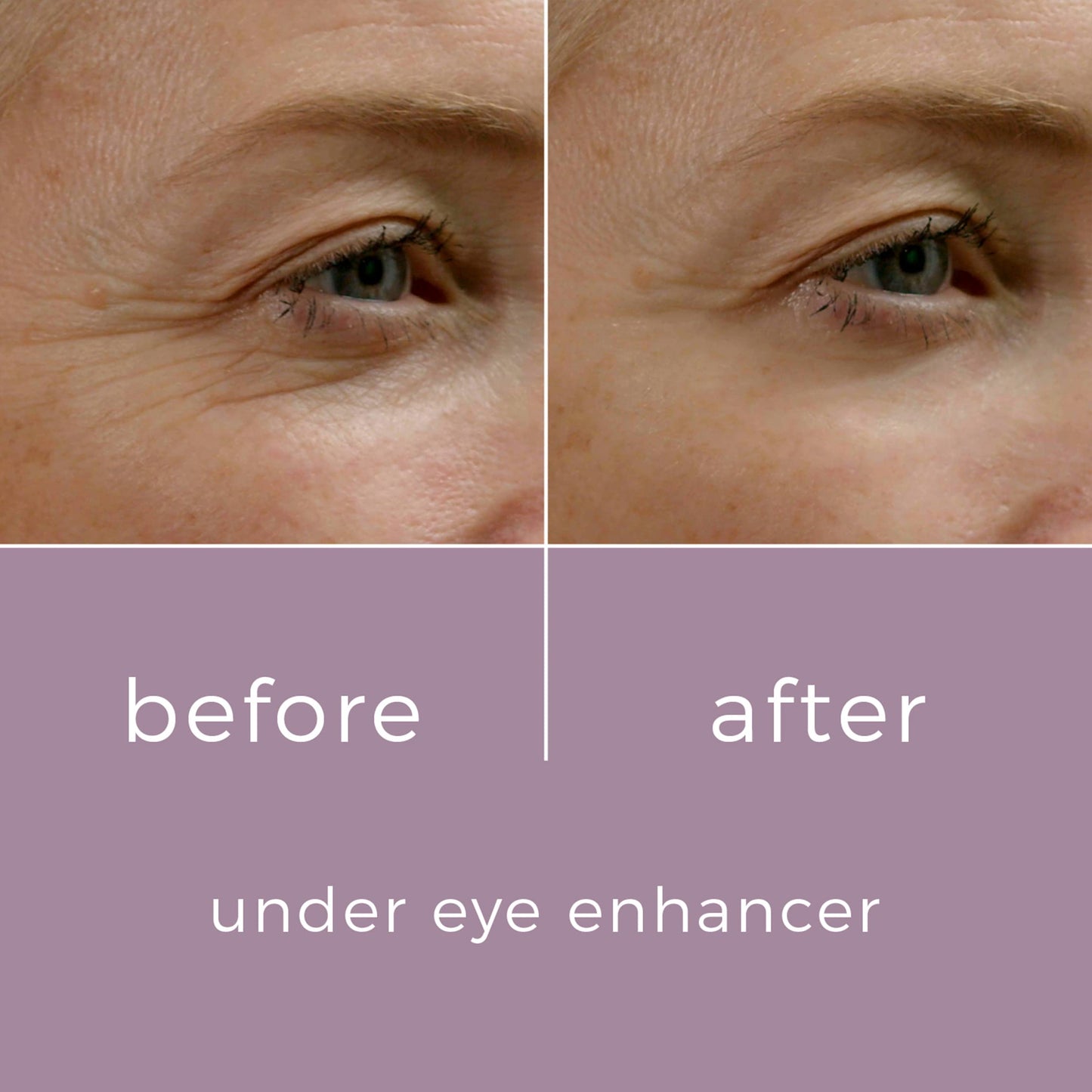 Skin Bunny Under Eye Enhancer – Eye Cream for Dark Circles and Puffy Eyes – Anti Aging Anti Wrinkles Caffeine Eye Cream for Eye Bags Remover Men and Women – Eye Serum 200 Applications