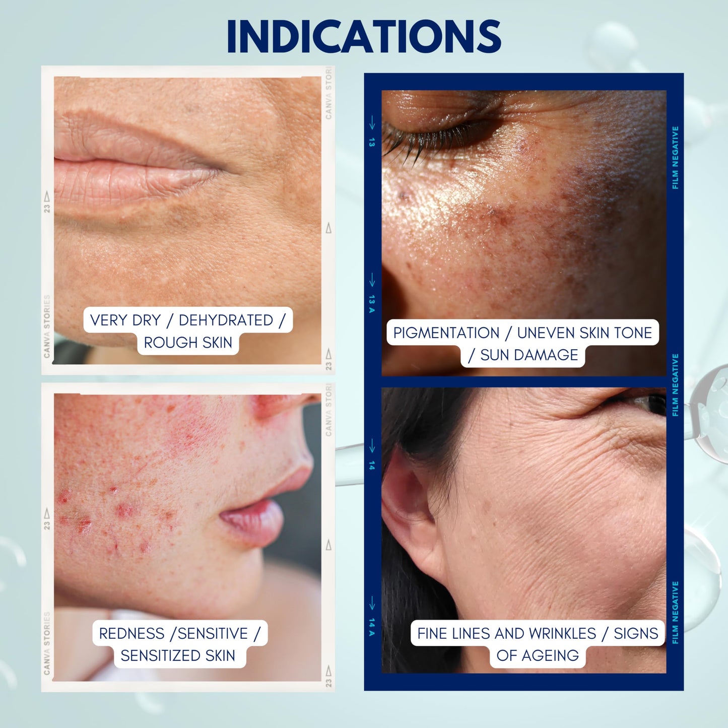 EGF REPAIR SERUM for face, 30ml, with Epidermal Growth Factor, Peptides, Glycerin, Increases Skin Moisture, Boosts Skin Renewal and Collagen Production, for HEALTHIER and YOUNGER looking skin