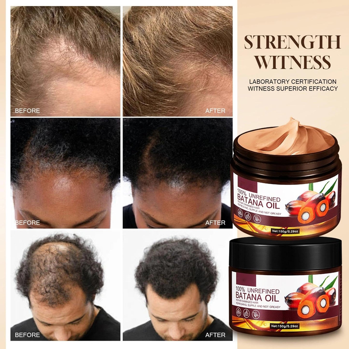 OunTechGlory Organic Batana Oil from Honduras for Hair Growth - Reduce Hair Loss, Split Ends, and Enhance Thickness - Ideal for Men and Women - 150g