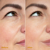 RSAFSBY Miracle Retinol Moisturizer – 2.5% Active Retinol, Vitamin E & Carnosine – Anti-Aging Face Cream for Fine Lines, Wrinkles & Dark Spots – Day & Night Hydrating Cream – 50ml