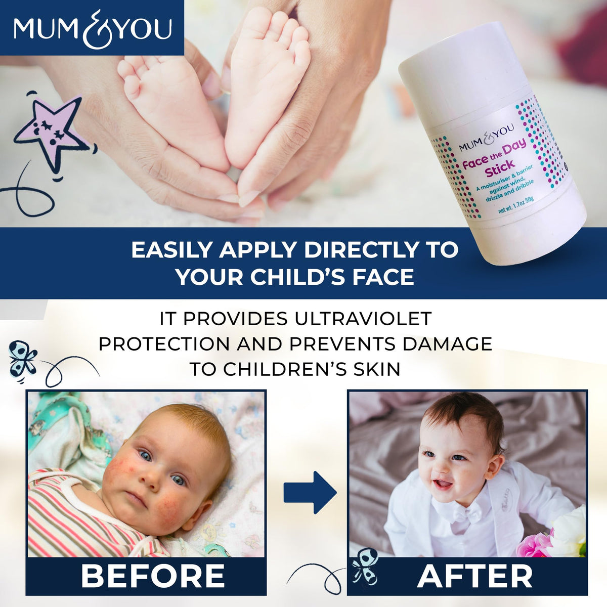 M&Y Mum & You Baby Face the Day Stick – 3 Natural Baby Moisturiser Sticks with Sunflower, Coconut Oil & Shea Butter, Soothes Eczema, Dribble Rash, Skin & Teething Protection – for Babies, Kids & Family