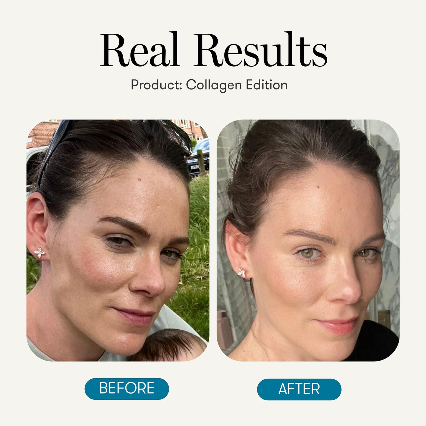 Equi - Collagen Edition, 20 Day Multivitamin Powder Supplement - Comprehensive Collagen Support, Enhanced Skin Glow, Anti-ageing, Bone & Joint Support, Collagen peptides, Glutathione, Vitamin C