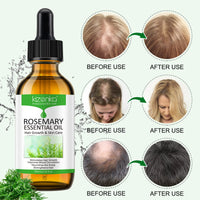 XAYGHE Rosemary Hair Growth Oil, Rosemary Essential Oil, Rosemary Oil for Hair Growth | Eyebrow and Eyelash Growth | Skin Care, 100% Pure Natural Hair Oil Serum, Stimulates Hair Growth, 60ml