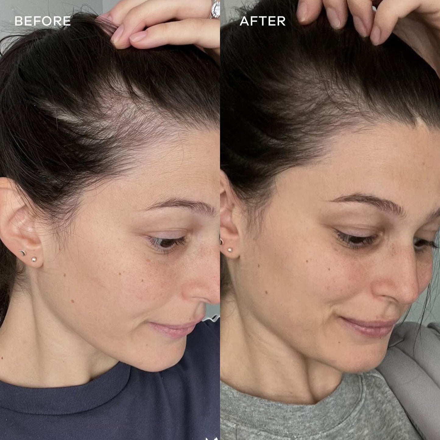 Vida Glow - Natural Hydrolysed Marine Collagen Sachets | Promotes Glowing Skin + Smooths Fine Lines (Original, 30 Sachets)