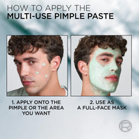 L’Oréal Paris men expert L'Oréal Men Expert Pimple Cream, Derma Control S.O.S Pimple Paste 45ml