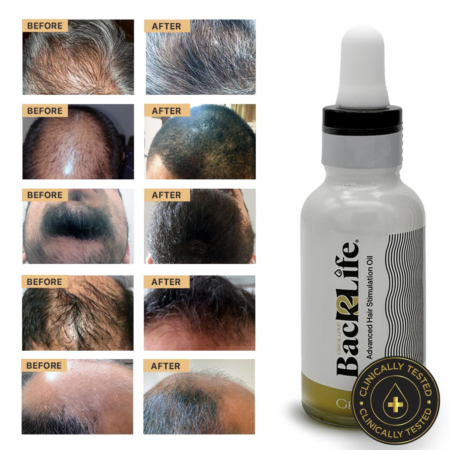 Back2Life Hair Back2Life 100% Natural Hair Stimulation & Beard Growth Oil-Get Rid of Patchy Beards & Hair-Beard serum to Moisturise, Hydrate & Condition-Repair & Rebalance Your Scalp & Regrow your Head & Beard Hair