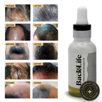 Back2Life Hair Back2Life 100% Natural Hair Stimulation & Beard Growth Oil-Get Rid of Patchy Beards & Hair-Beard serum to Moisturise, Hydrate & Condition-Repair & Rebalance Your Scalp & Regrow your Head & Beard Hair