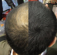 LDN Professional Hair Building Fibres for Hair Loss and Thin Hair, No.1 for Instantly Thickening Hair Naturally, 20g hair fiber bottle (Black)