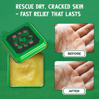 Bag Balm Original Skin Moisturiser with Lanolin |All-Purpose Hydrating Balm for Dry, Chafed Skin | Soothes Cracked Hands, Split Heels & Cuticles | Paraben-Free (28g)
