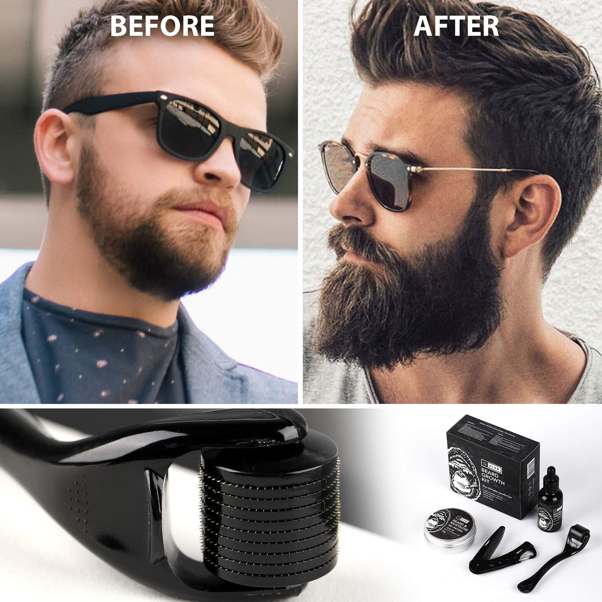 uLab Ultimate Gorilla Beard Growth Kit with Derma Roller, Beard Oil, Beard Balm and Foldable Styling Comb - Gift Set for Men For Beard Growth, Styling and Care - Contains Microneedle Titanium Roller