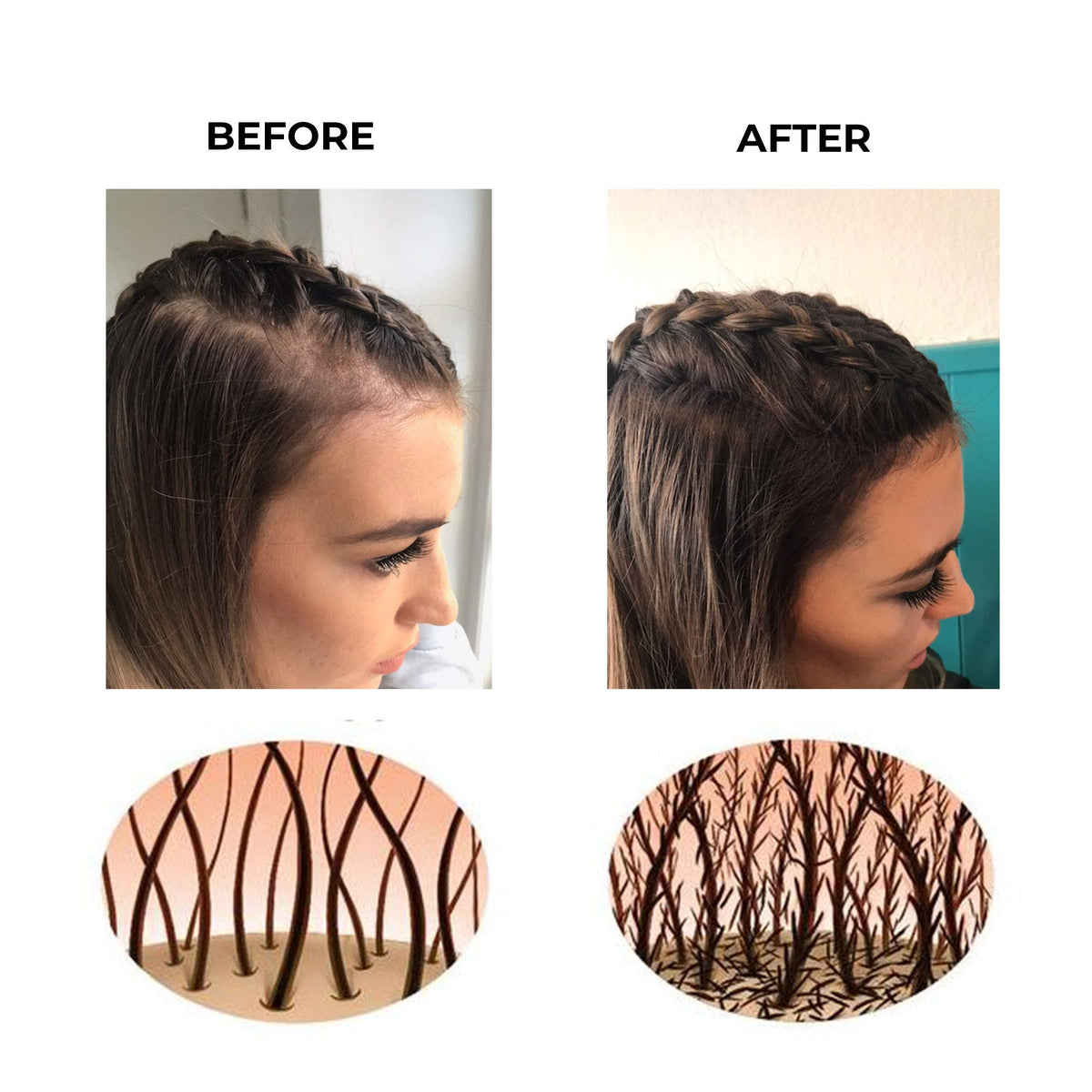 Hair Fibres by Keratech Pro 12ml | Instantly Fuller Hair | Advanced 100% Natural Keratin formula (Black)