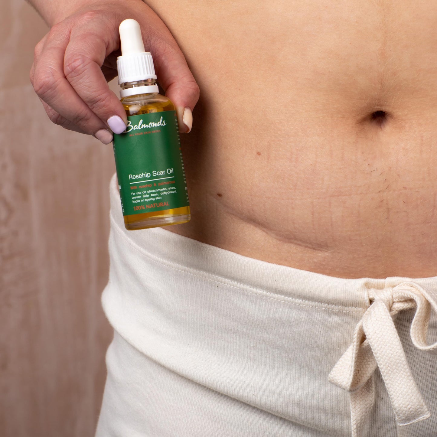 Balmonds Rosehip Scar Oil 50ml - 100% Natural Blend of Nourishing Oils - Helps Improve The Appearance of Scars, Uneven Skin Tone, Acne Scars & Stretch Marks - Hydrate, Nourish and Moisturise