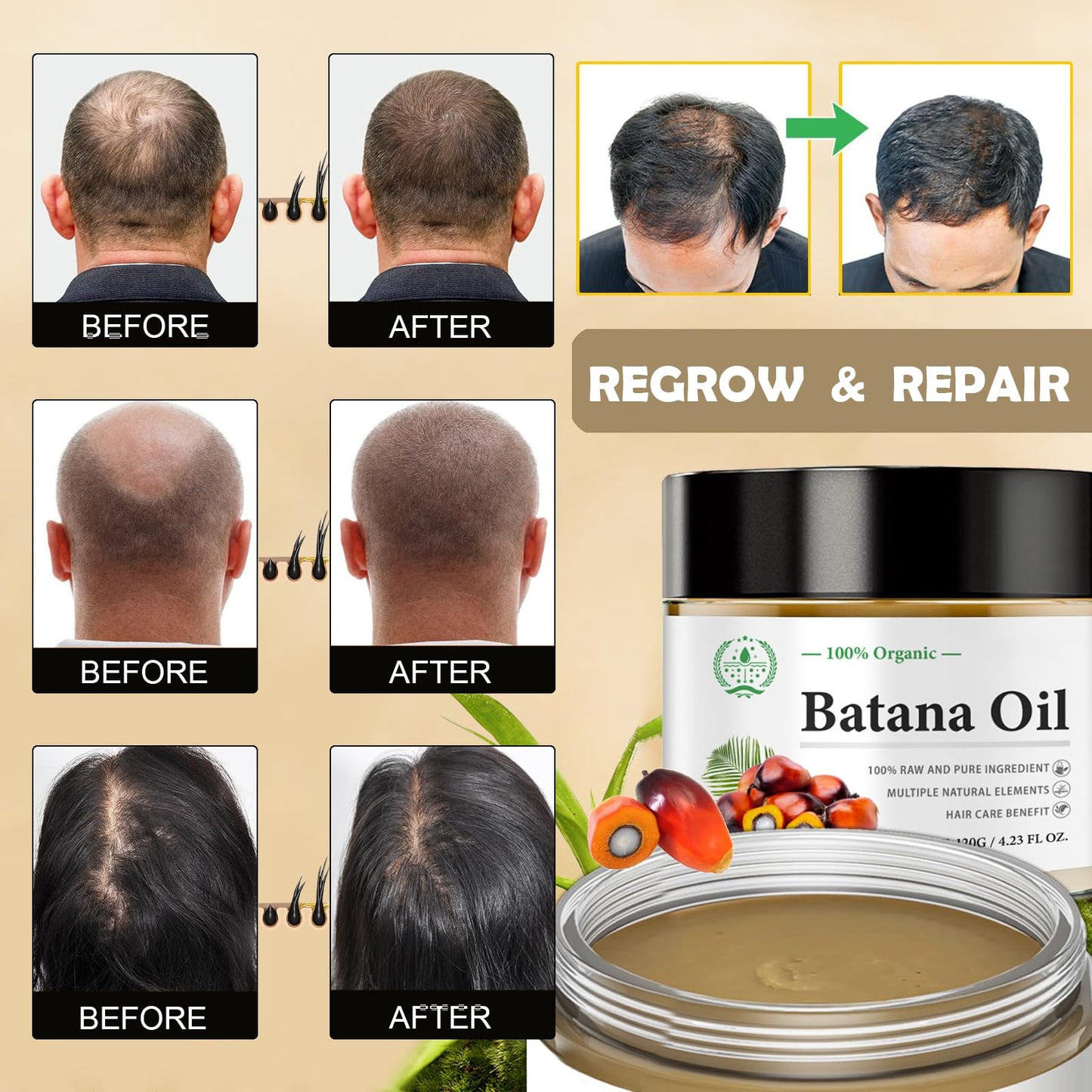 MINSHZEE Batana Oil for Hair Growth, 100% Pure Natural Batana Oil from Honduras, Organic Batana Oil as Hair Mask, Reduces Hair Loss Repairs Damaged Hair Scalp and Hair Care (120g)