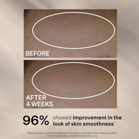 StriVectin Peptide Plump™ Line Filling Serum (30ml) | Alpha 3 Peptides to Hydrate Skin & Plump Skin, Bounce