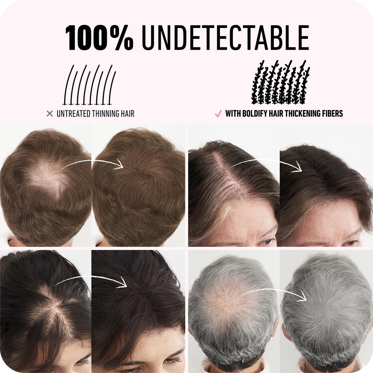 Boldify BOLDIFY Hair Fibres (56g) - Fill In Thinning and Fine Hair for an Instantly Fuller, Thicker Look - 14 Shades for Women and Men - Ash Brown