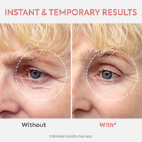 VELAMO ADVANCED Instant Eye & Face Lift Cream: Rapid Under Eye Bags Wrinkles Smile Lines Forehead Lines Remover - Temporary Firming & Tightening Treatment in 2 Minutes, 30g