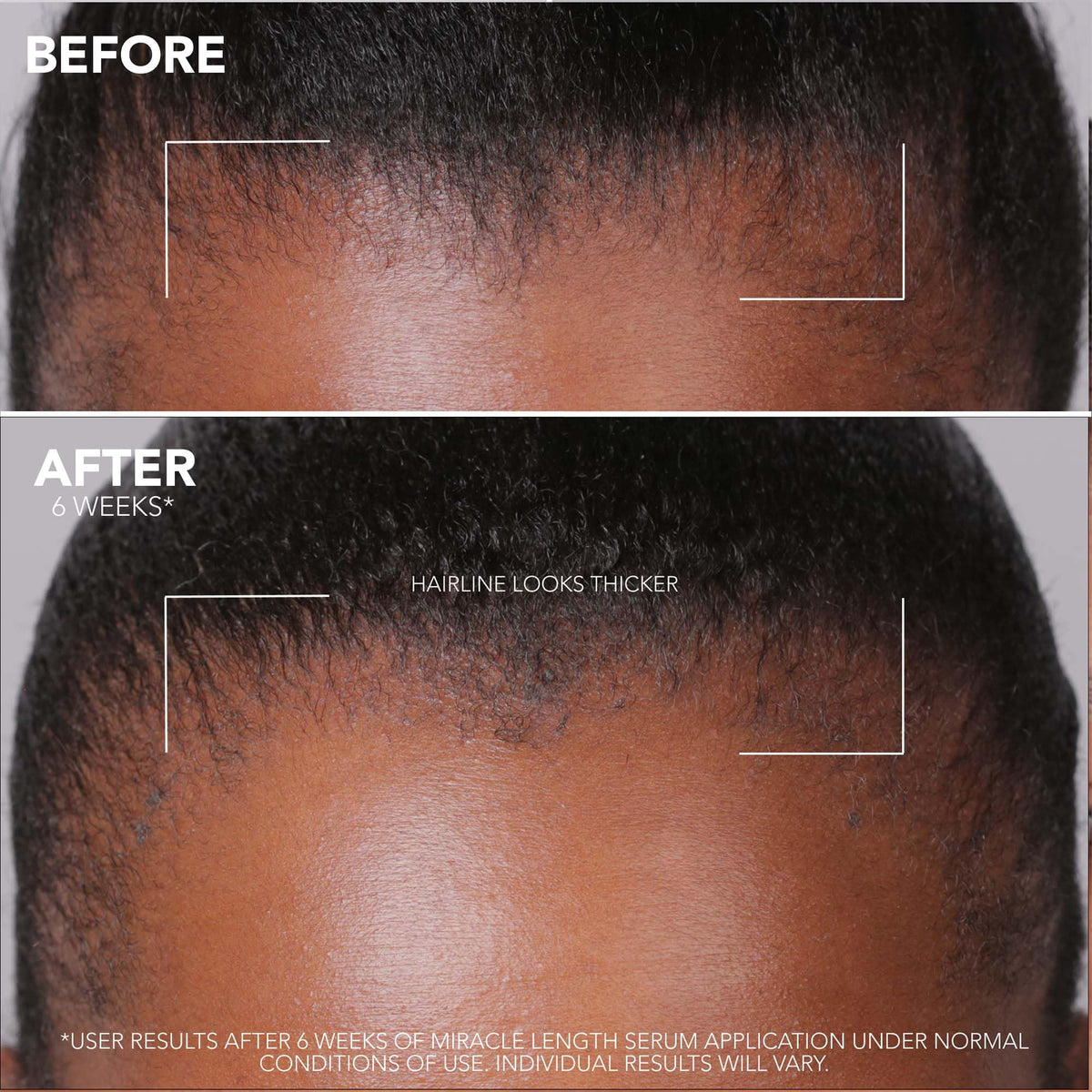 MIZANI Mizani Anti Hair Loss Serum, Strengthening and Thickening Treatment, For Healthier-Looking Hair, Enriched with Castor Oil and Stemoxydine, 25 Miracle Length, 90ml