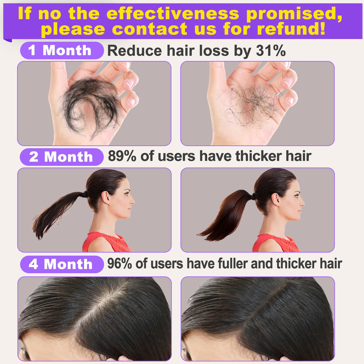 GoldWorld Rosemary Oil for Hair Growth,Diluted Rosemary Oil with Sclap Massager&Ebook,Hair Growth Oil Serum with Castor Oil Biotin Argan for Dry Damaged Hair,Hair Ingrown Loss Treatments for Women Men