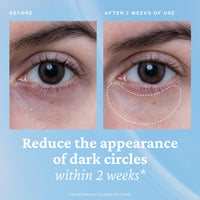 belif Aqua Bomb Eye Gel, Hydrating&Depuffing Eye Treatment with Caffeine&Niacinamide reduces eye bags, dark circles & fine lines, Suits All Skin Types, Safe for Sensitive Skin, Korean Skincare(15ml)