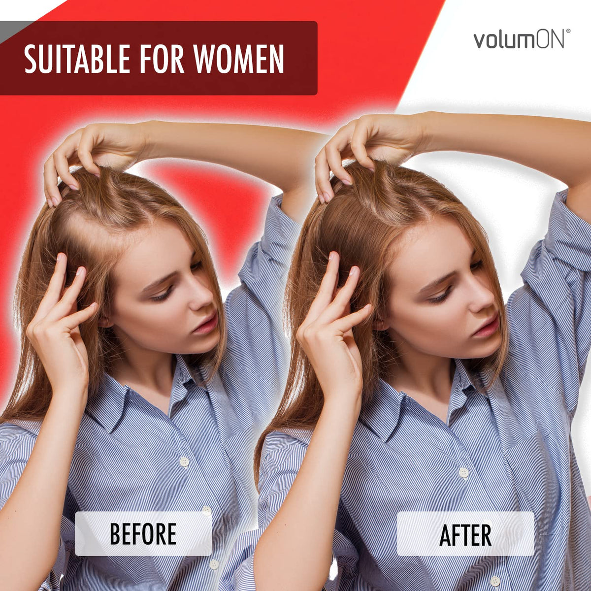 Volumon Professional Hair Building Fibres- Hair Loss Concealer- KERATIN- BLACK 28g- Get Upto 30 Uses