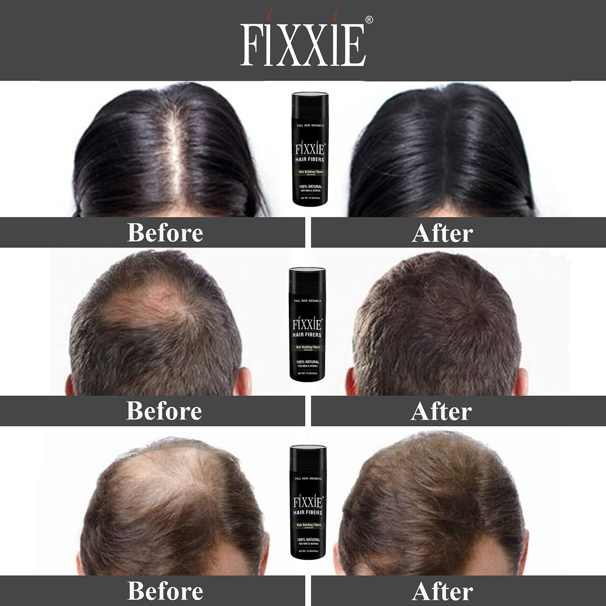 FIXXIE, fixxie Hair Fibres with Applicator + Comb, 82.5g Natural Keratin Hair Thickening Fibers for Thinning Hair, Hair Thickener For Women & Men, 27.5g X 3 Bottles (Pack of 3, Black)