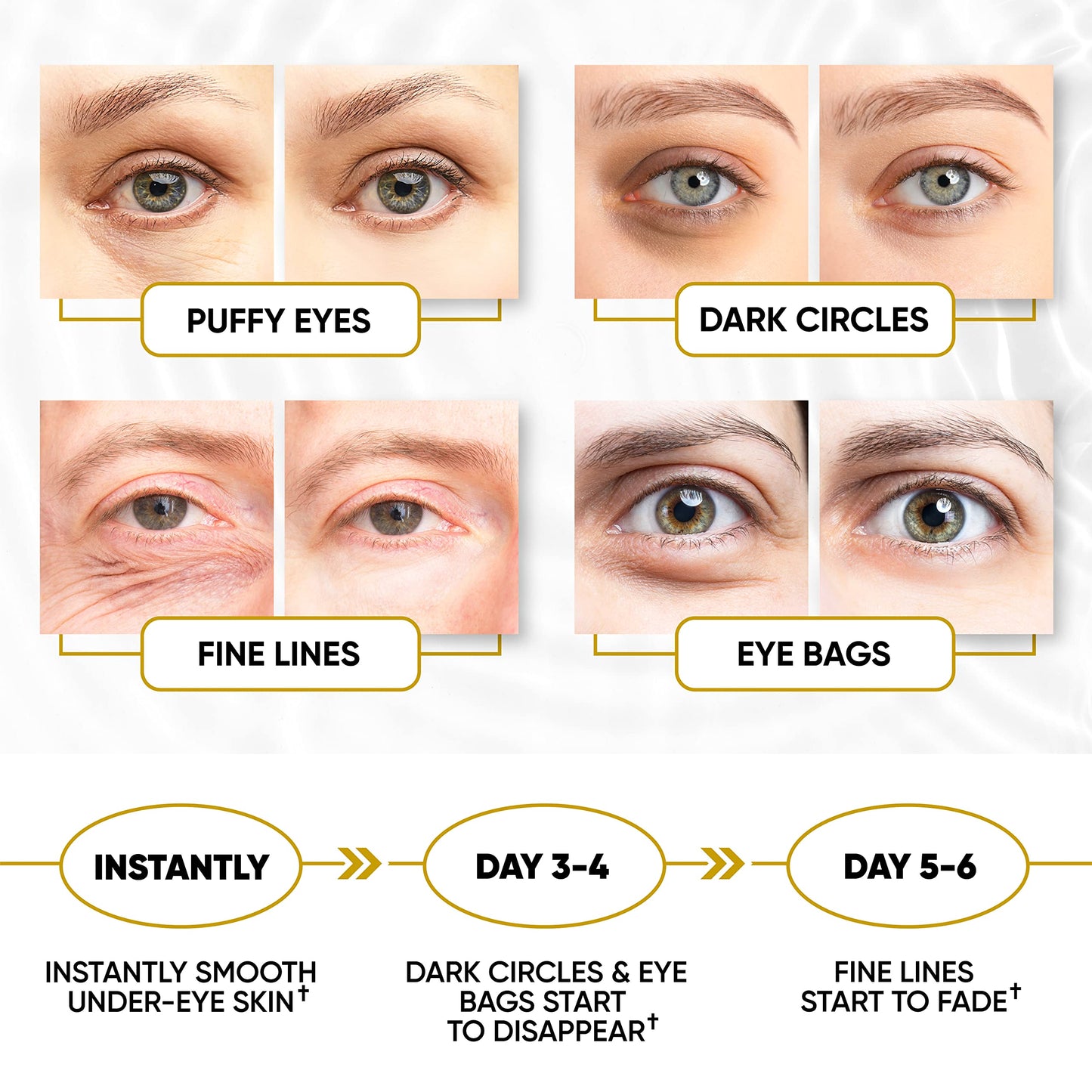 Lorelis Lab 24k Gold Eye Masks for Puffy Eyes and Dark Circles - Anti-Aging, Moisturizing Effect - Under Eye Patches with Collagen, Hyaluronic Acid for Eye Bags, Fine Lines, Wrinkles - Under Eye Masks, 30 Pairs