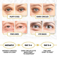 Lorelis Lab 24k Gold Eye Masks for Puffy Eyes and Dark Circles - Anti-Aging, Moisturizing Effect - Under Eye Patches with Collagen, Hyaluronic Acid for Eye Bags, Fine Lines, Wrinkles - Under Eye Masks, 30 Pairs
