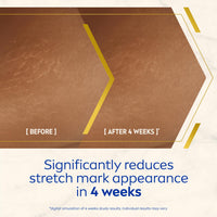 NIVEA Luminous 630 Body Oil Serum Anti Stretch Marks (100ml), Skincare Serum with Luminous 630 Visibly Reduces Stretch Marks in 2 weeks, Starts Working From Day 1, with Thiamidol