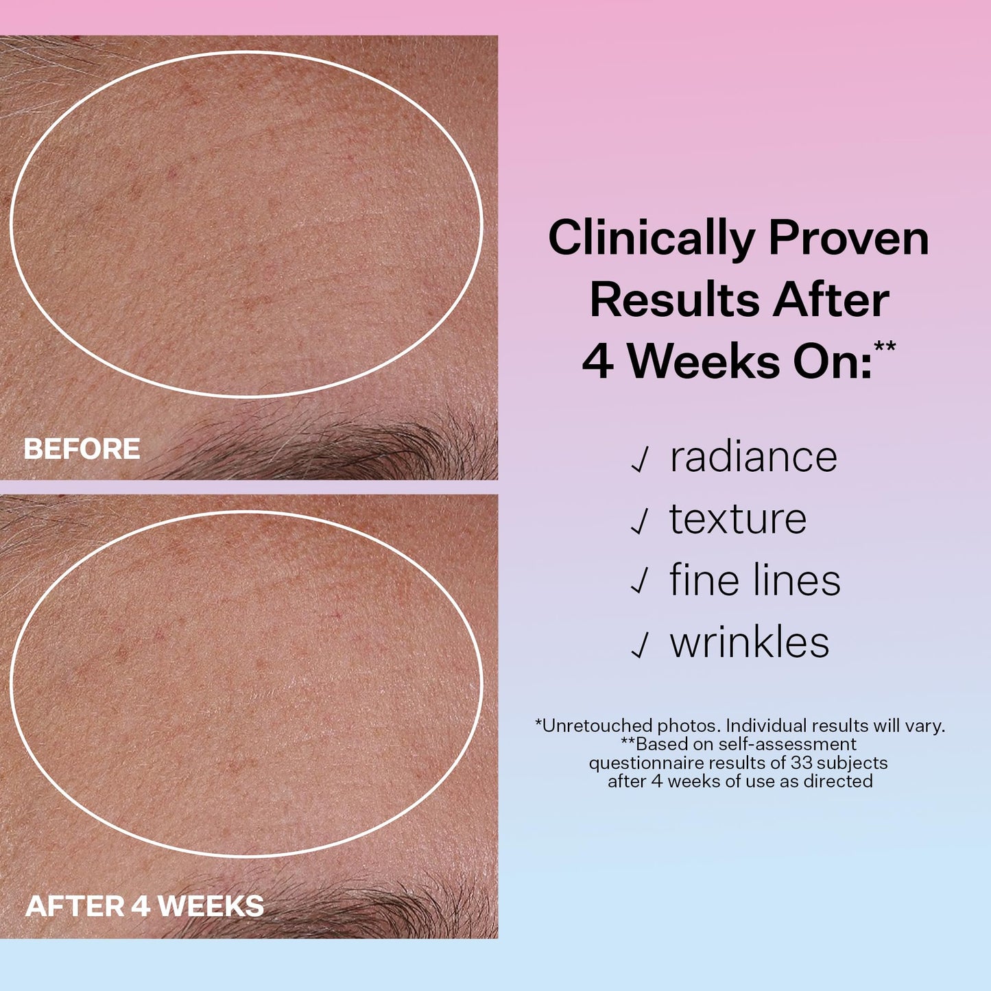 StriVectin Multi Action Hydration Multiplier Hyaluronic Acid Serum, Ceramides and Peptides for Dehydrated, Dry Skin 1 oz