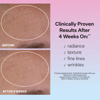 StriVectin Multi Action Hydration Multiplier Hyaluronic Acid Serum, Ceramides and Peptides for Dehydrated, Dry Skin 1 oz