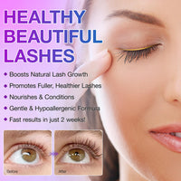 mysemgshuo Eyelash Growth Serum, 5ML Lash Enhancer for Fuller, Thicker, Longer Natural Lashes