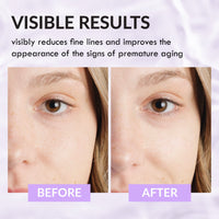 Wake Skincare Face Cream for Dry Skin, Moisturiser for Dry Skin - Hyaluronic Acid Moisturiser - 50ml, Dry Skin Cream - Natural Antioxidants & Dry Skin Face Cream, Face Moisturiser for Dry Skin