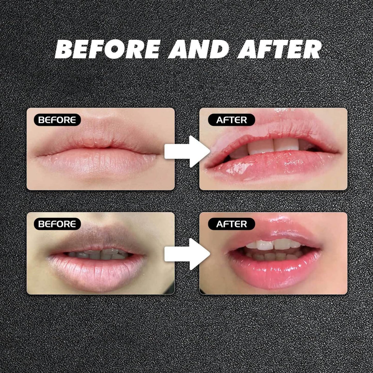 Lip Lightening for Dark Lips, Hydrating & Brightening Lip Repair Balm, Lip Exfoliator Scrub for Softening & Moisturizing,Pigmentation Corrector