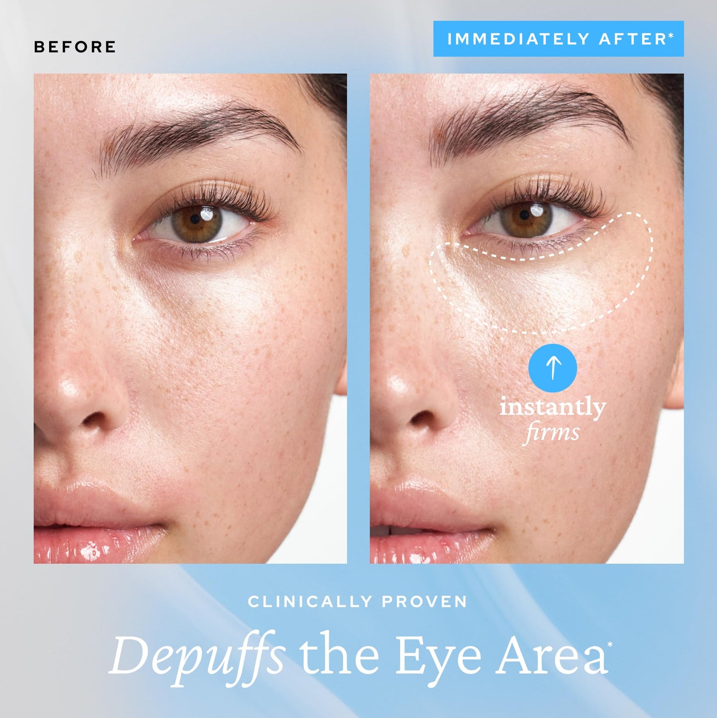 belif Aqua bomb eye gel | Caffeine, hyaluronic acid & niacinamide to cool, hydrate & depuff under-eye area, reduces eye bags, dark circles & fine lines, Korean beauty, Korean skincare(15ml)